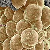 Fat Cells (scanning electron microscopy)